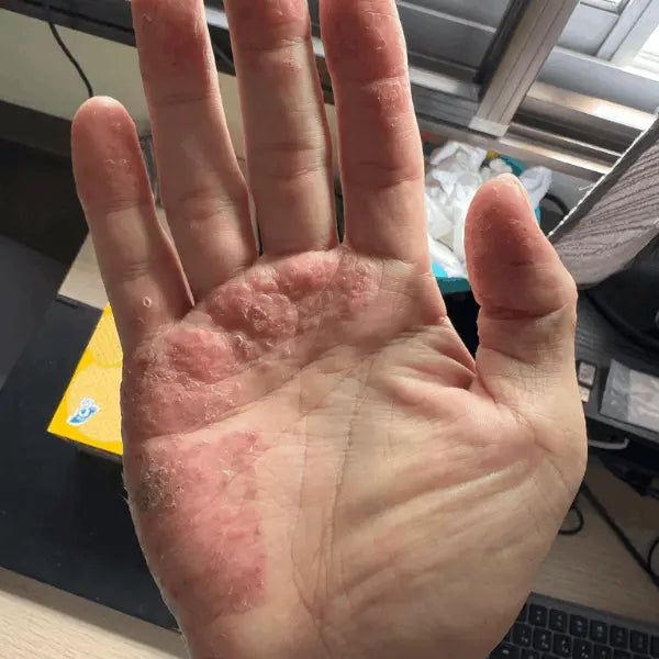 Day 1