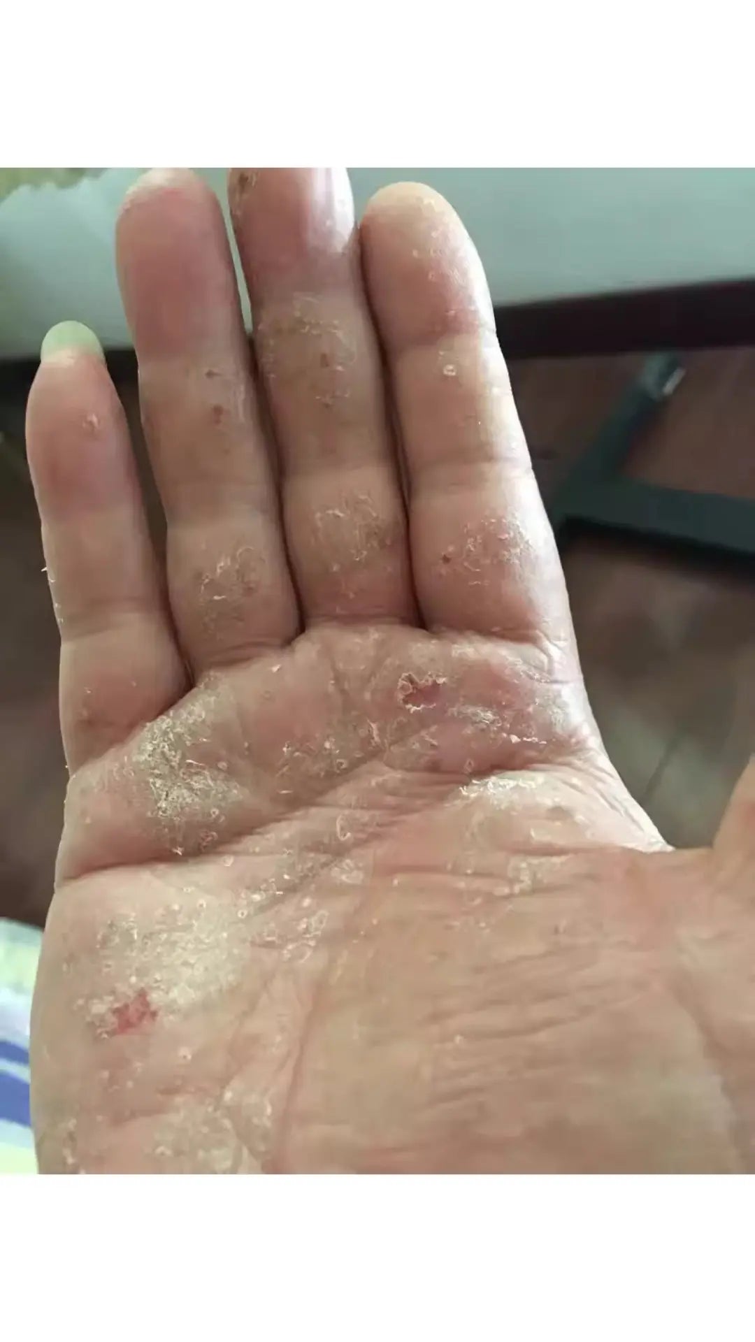 Day 1