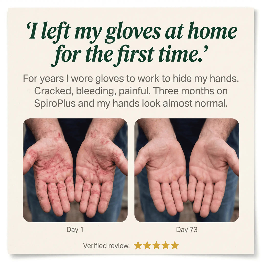 SpiroPlus — The Gut-Skin Chewable