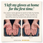 SpiroPlus — The Gut-Skin Chewable